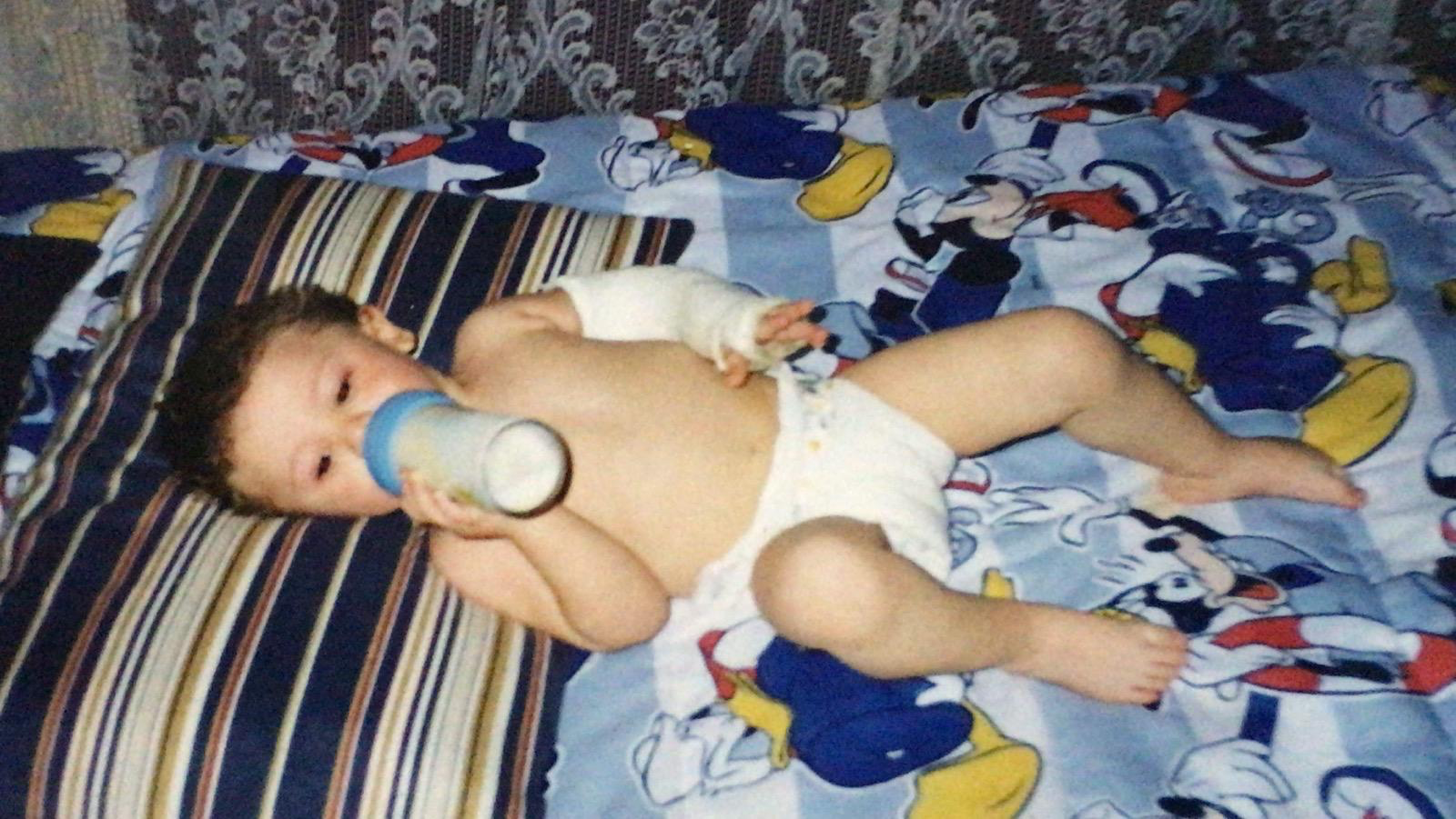 Patrick com gesso no braço